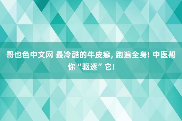 哥也色中文网 最冷酷的牛皮癣， 跑遍全身! 中医帮你“驱逐”它!